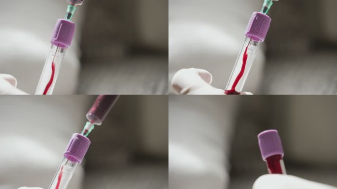 医生抽血给病人做血液检查，年度检查