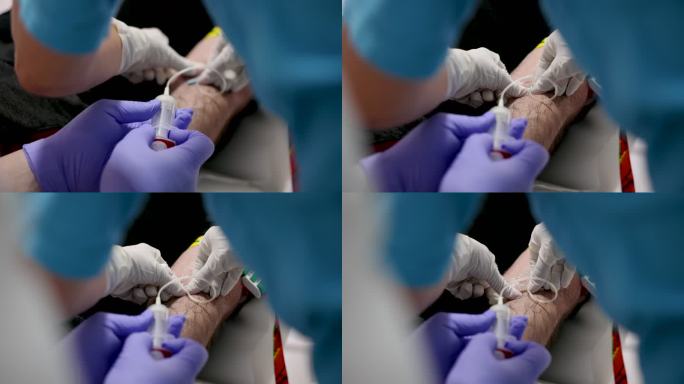 无法辨认的医生和护士采集患者血液的视频蒙太奇