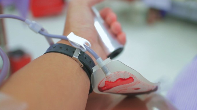 献血，特写医院化验室检验科抽血体检