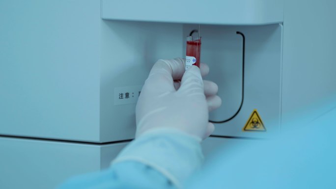 医院检验科血液检验设备仪器3
