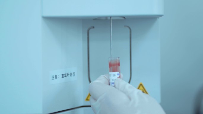 医院检验科血液检验设备仪器检验结果7