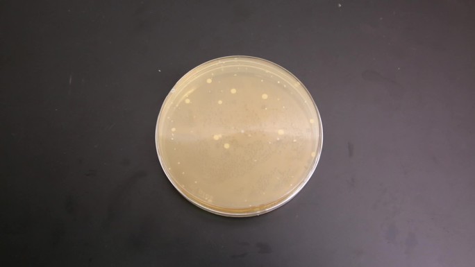 危险食品安全实验室检验菌落细菌培养皿
