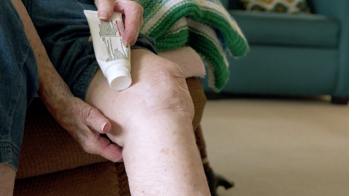 老年妇女应用止痛膏治疗膝盖和关节疼痛