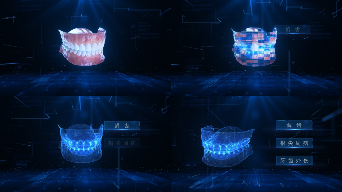 牙齿口腔扫描科技三维视频素材