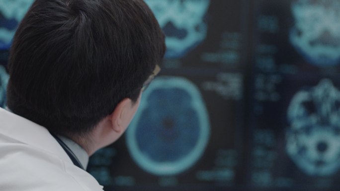 医生分析监视器上显示的脑部扫描结果。