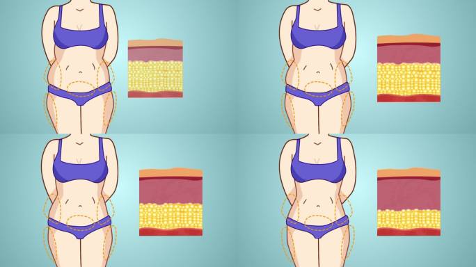 减肥 脂肪层 瘦身 卡通