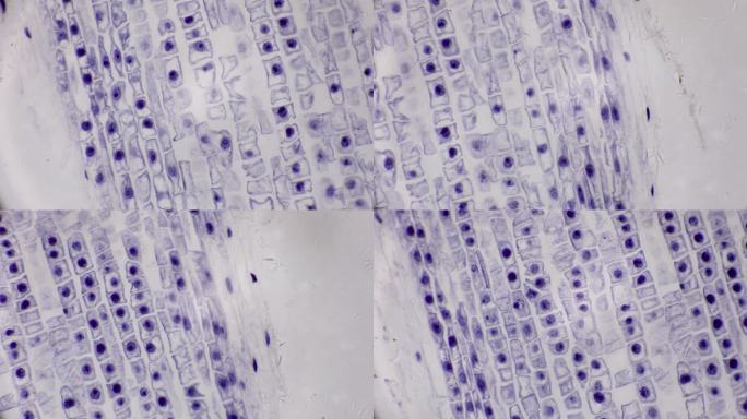 蚕豆植物细胞的显微观察