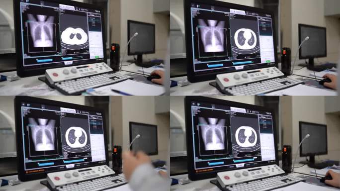 影像科肺部CT检