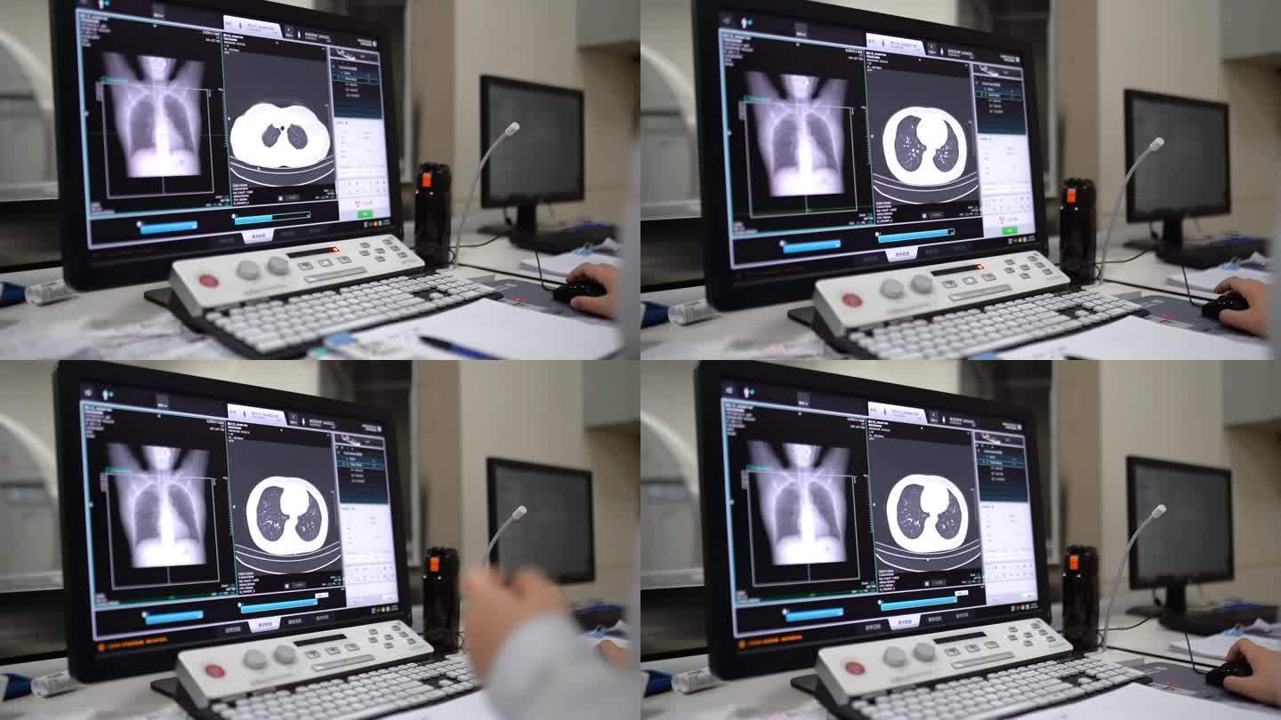 影像科肺部CT检