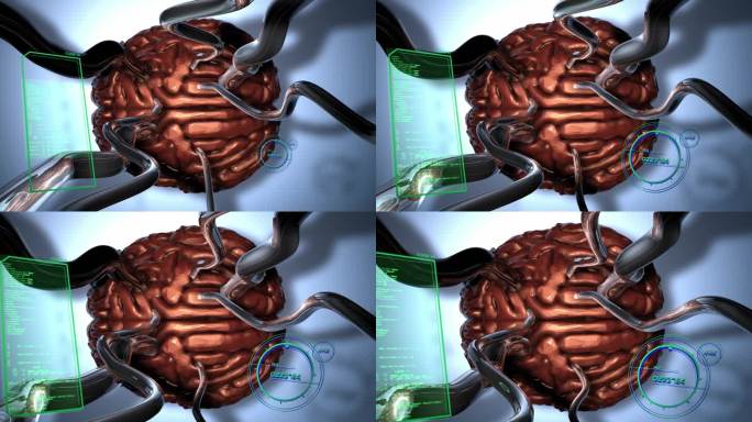 大脑连接人体部位检查扫描抽象