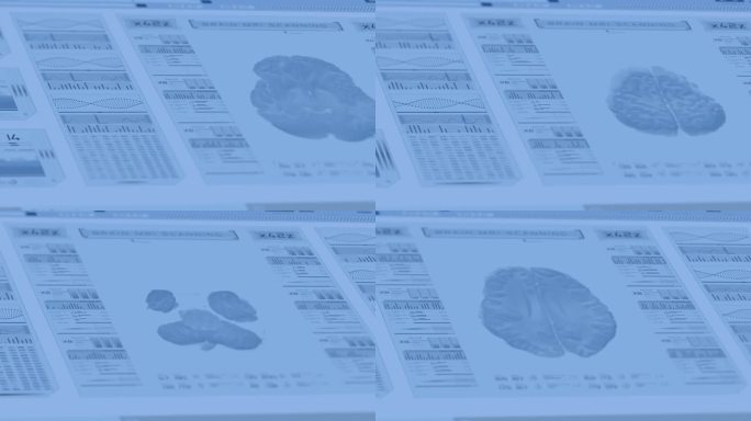 3D渲染未来大脑分析技术中的解剖大脑旋转HUD概念包括许多蓝色数字元素。
