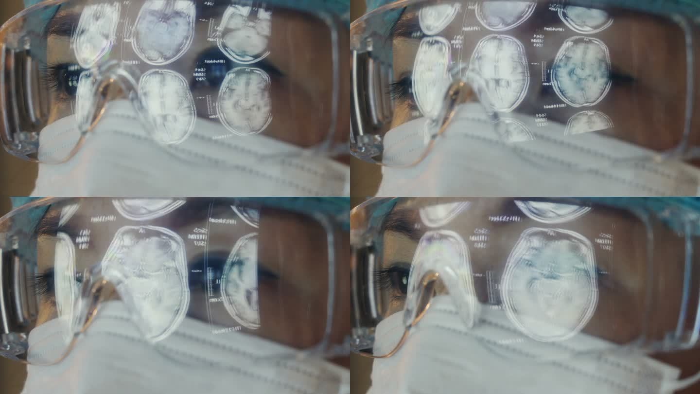 眼镜上的反射CT检查图像，医生看着电脑监视器