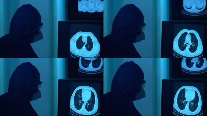 在放射科诊所的计算机监视器上看到的冠状病毒阳性患者胸部CT图像的4K视频