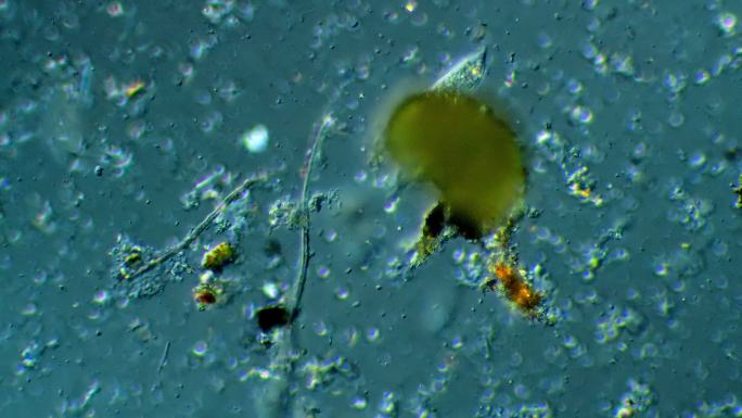 显微镜下的微生物宣传片广告实拍素材活体物