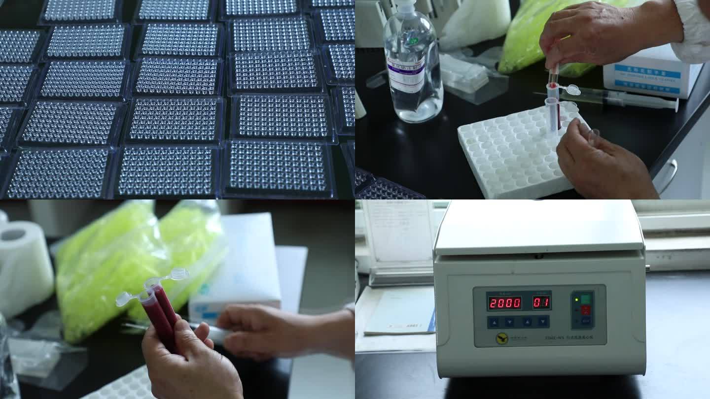 血液检测 血凝实验 样本 材料 离心机