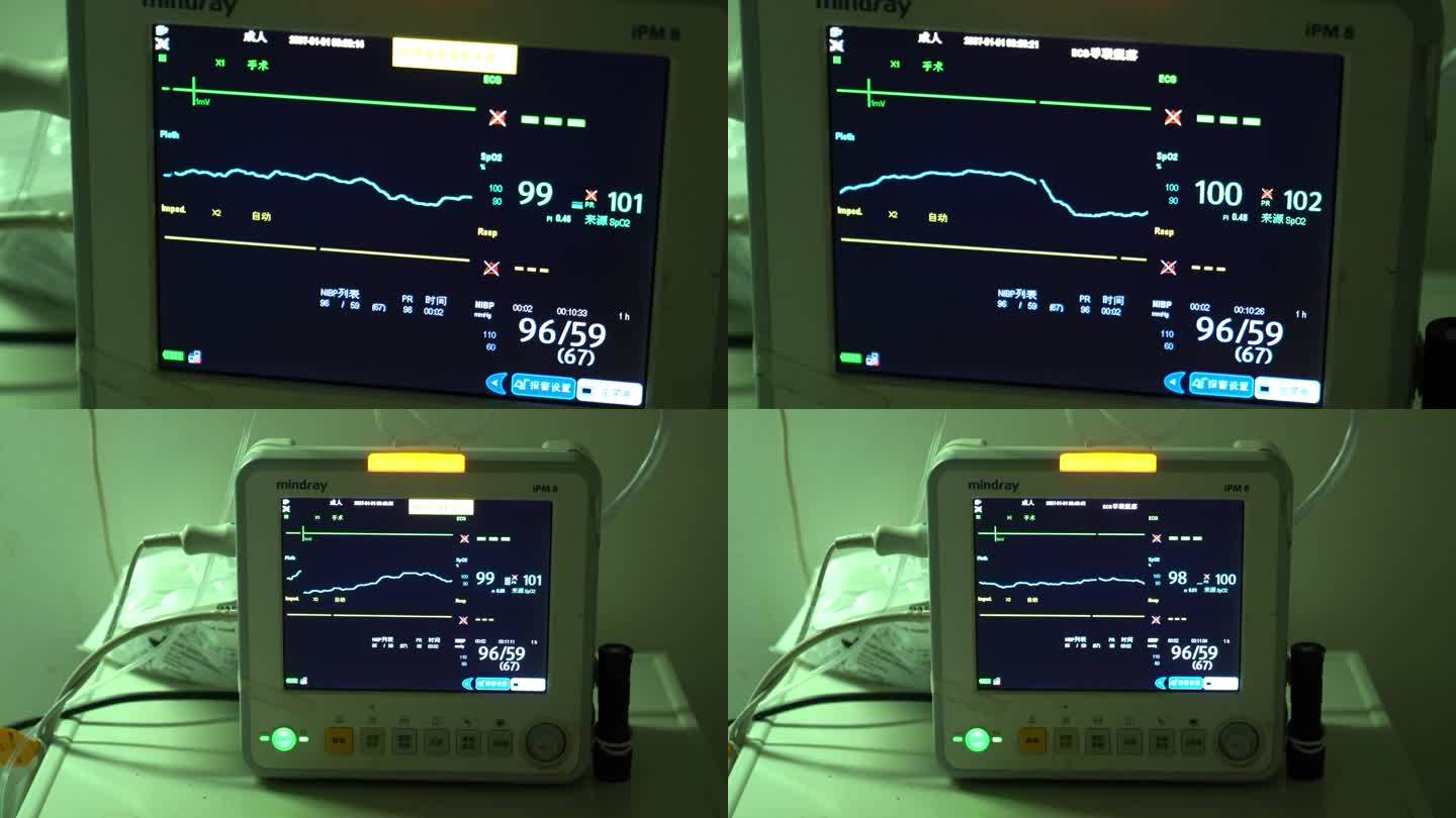 心跳监护仪、生命监测仪
