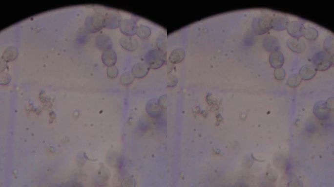 竖屏科技生物显微镜下的啤酒酵母