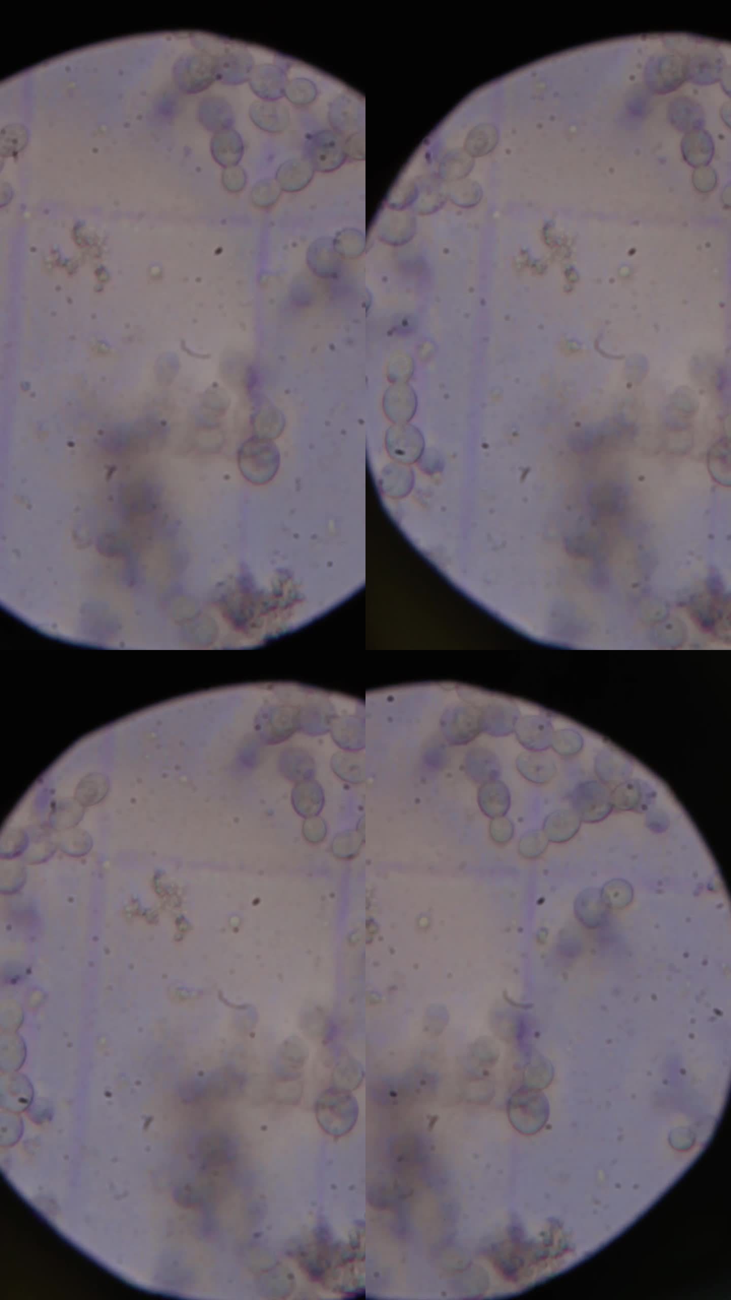 竖屏科技生物显微镜下的啤酒酵母横移