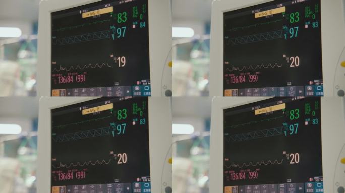 心电监护仪显示体征稳定