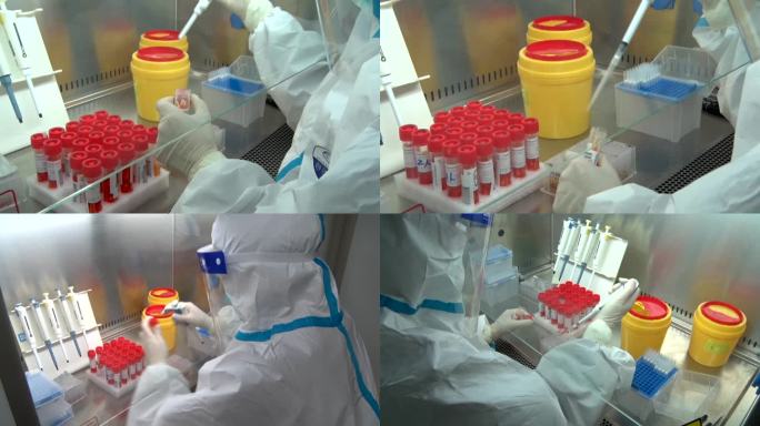 核酸试剂检测 核酸样品检测实验室