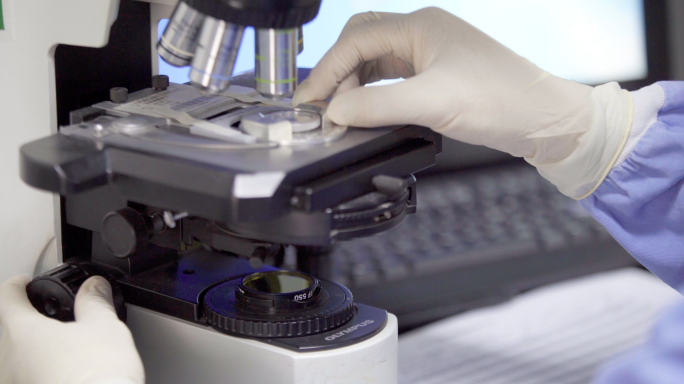 4k医学检测 医学化验 显微镜 精子检测