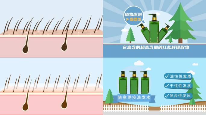 MG动画-头发 毛囊问题 洗发水广告