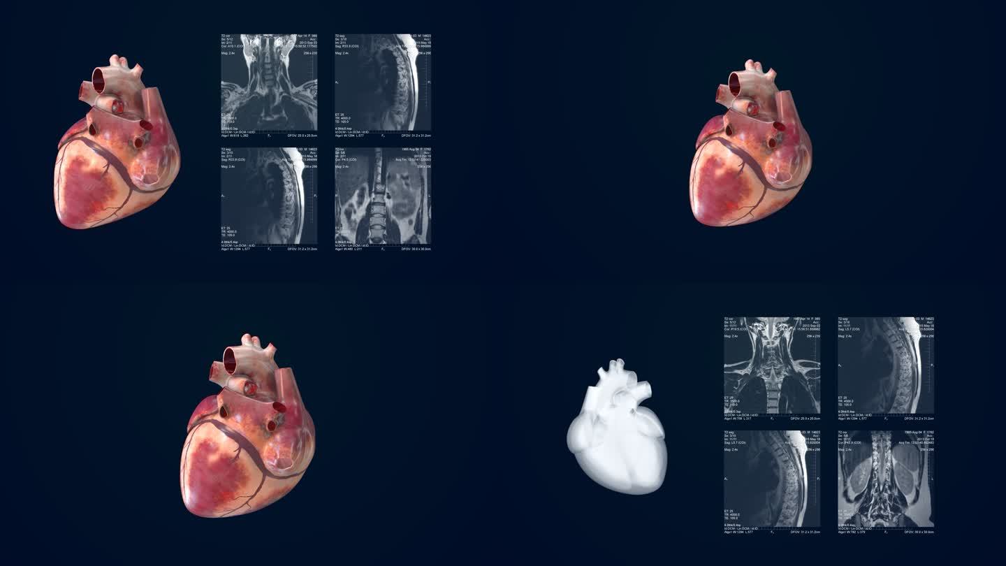 医院心脏器官核磁共振彩超三维展示