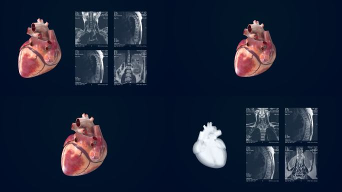 医院心脏器官核磁共振彩超三维展示