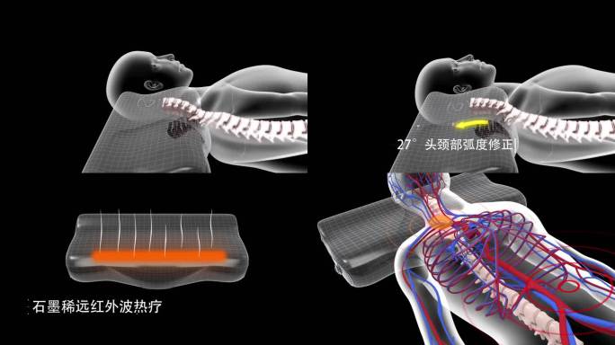 颈椎三维动画，颈椎病，石墨烯，颈椎，神经