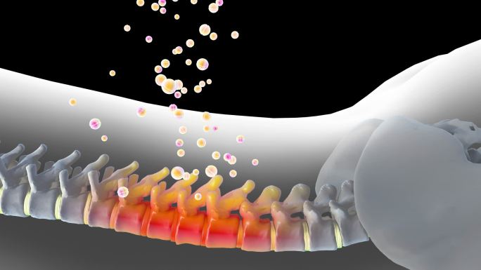 药物渗透腰椎恢复正常