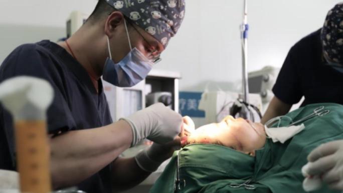 脂肪抽取面部填充手术视频素材