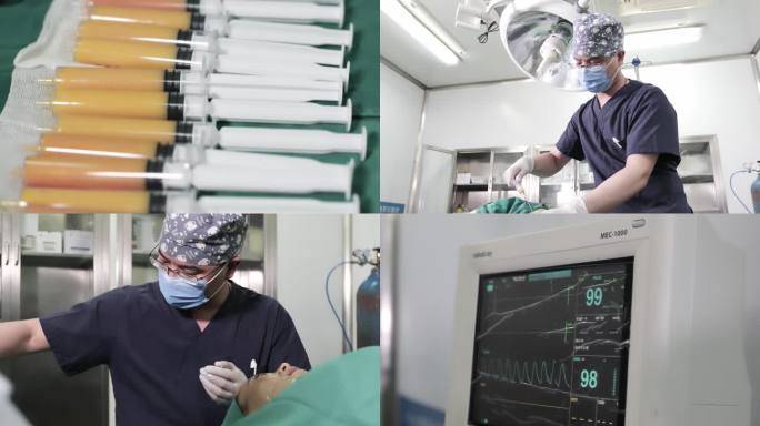 脂肪抽取面部填充手术视频素材