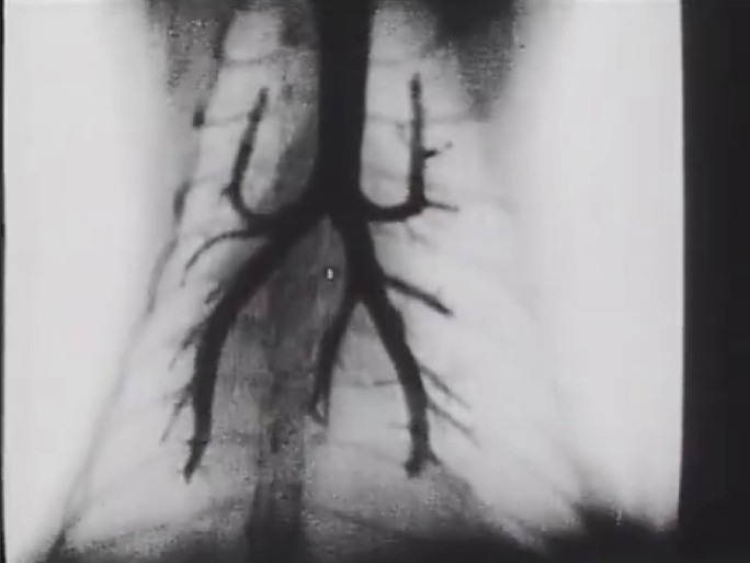 早期医疗影像学 上世纪X射线