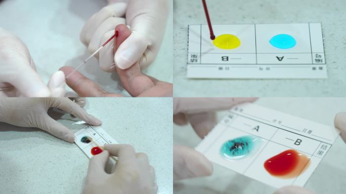 简易血型检测 血库ABO血型检测