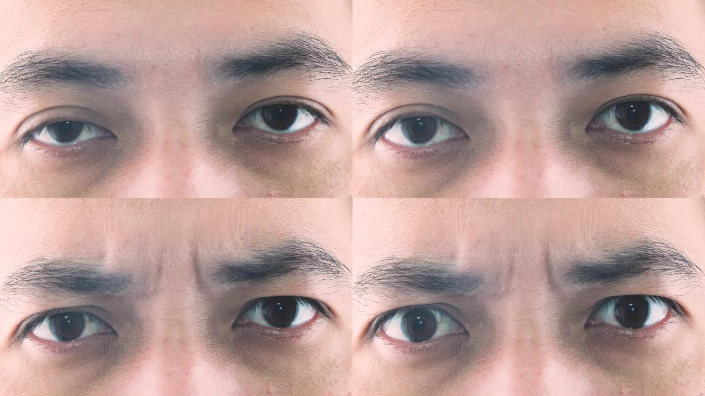 亚洲男人眼睛眼部特写睁眼皱眉愤怒情绪