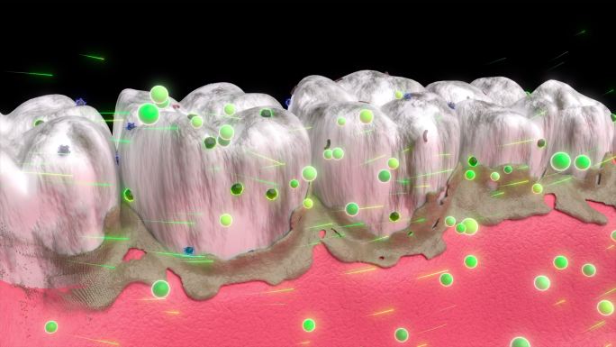 牙齿清洁去除牙菌斑带通道
