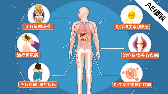 维生素D3转变过程AE模板