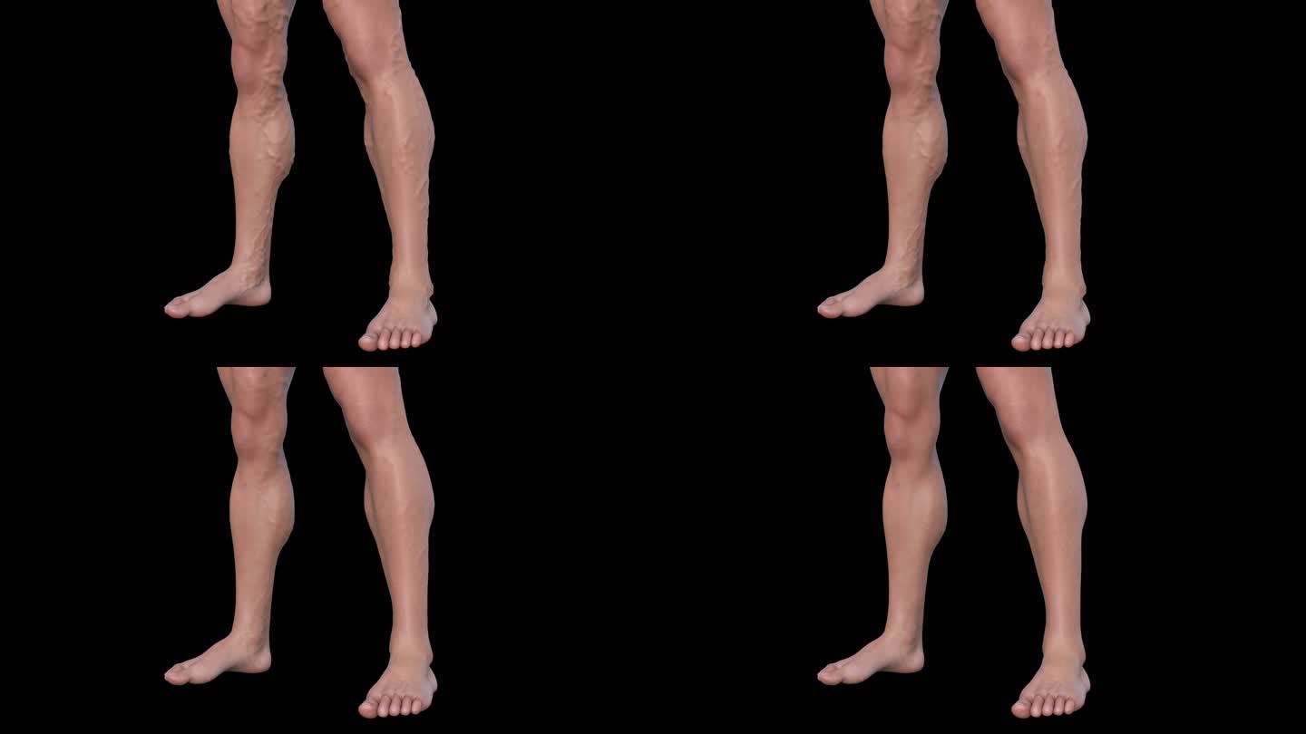静脉曲张消失3D人物腿部血管肿胀恢复动画