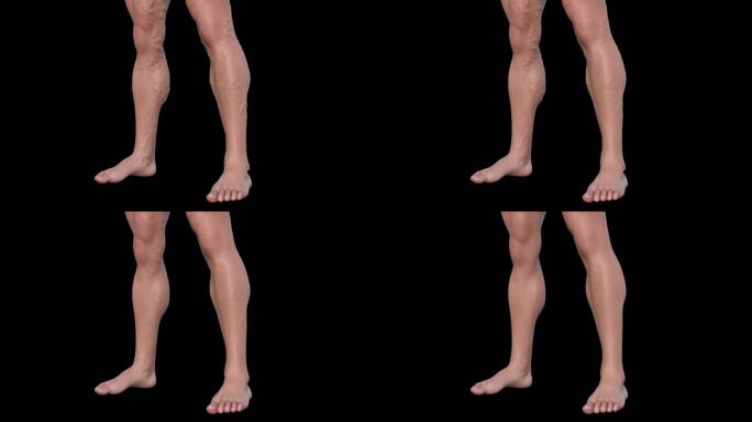 静脉曲张消失3D人物腿部血管肿胀恢复动画