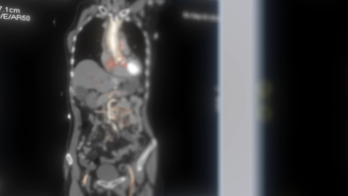MRI影像 CT影像 动脉血管影像