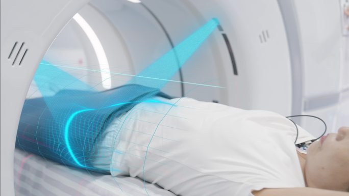 CT扫描 脑部检查 颈动脉 腹部检查