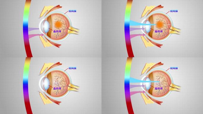 视力眼球黄斑区