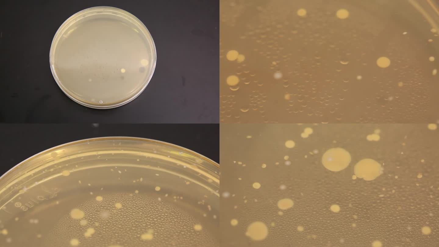 【镜头合集】实验室检验采集细菌样本菌2