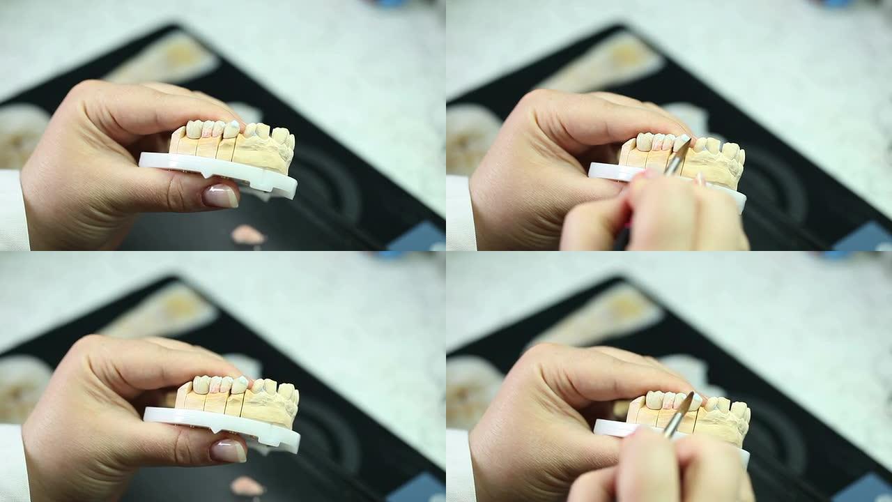 牙科修复学修补牙科大夫补牙