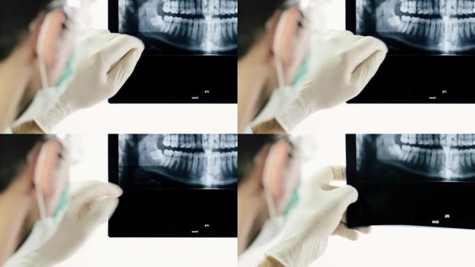 牙医检查X射线图像