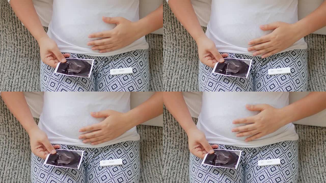 孕妇进行妊娠试验和超声扫描