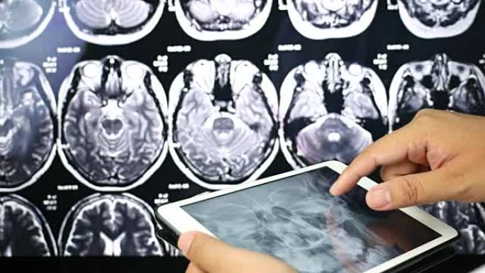 医生使用数字平板电脑检查颅骨脑x射线扫描，医疗保健和医学概念