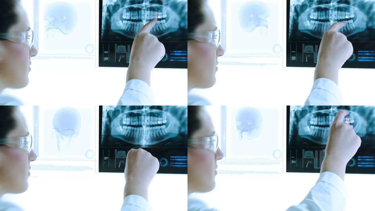 现代X射线图像。牙医研究。