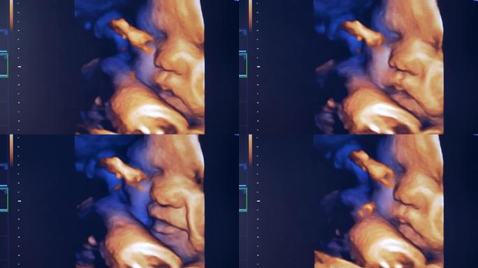 超声监视器上胎儿的实时图像。子宫中未出生的真实形象。