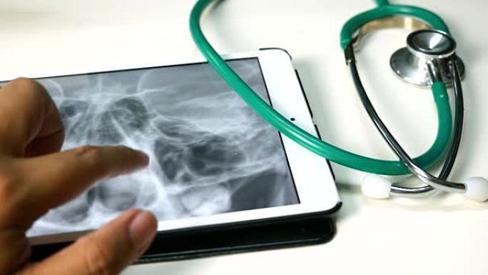 医生检查平板电脑上的颅骨x射线MRI图像，医疗保健和医学概念